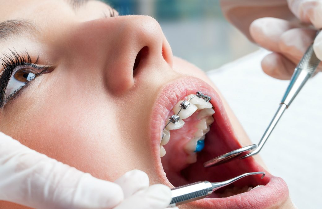 Top Benefits Of Orthodontic Treatment