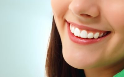 Crowns vs Veneers : Which Is Best for You?