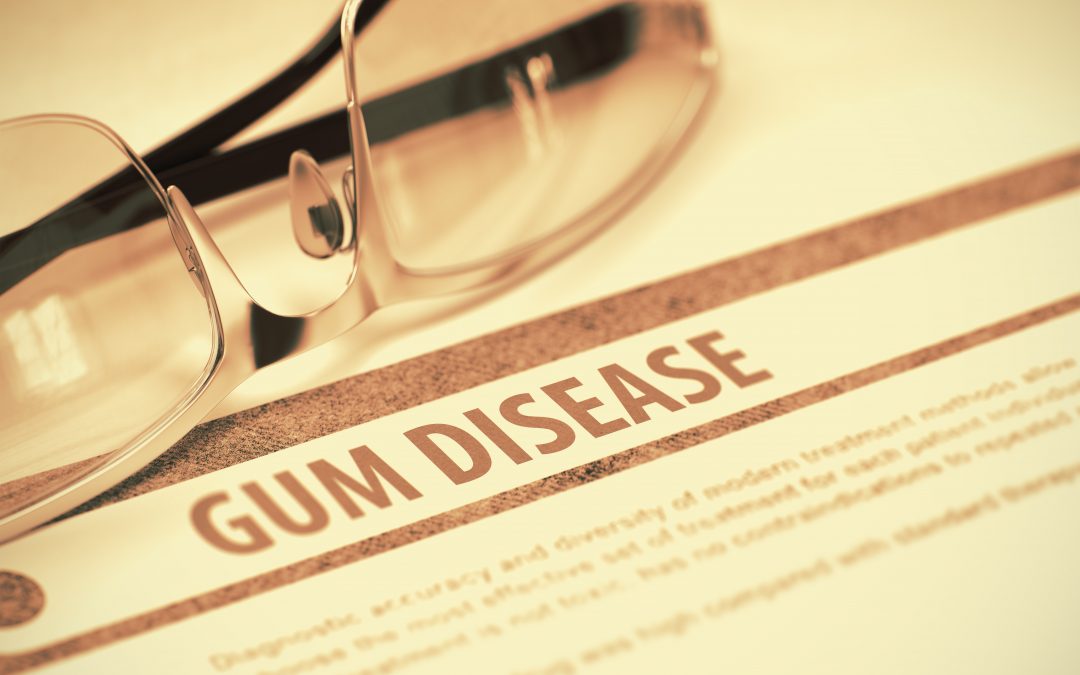 Causes And Treatment Of Gum Disease